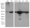 DExD-Box Helicase 39B antibody, M03490, Boster Biological Technology, Western Blot image 