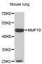 Matrix Metallopeptidase 19 antibody, STJ28740, St John