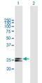HscB Mitochondrial Iron-Sulfur Cluster Cochaperone antibody, H00150274-B01P, Novus Biologicals, Western Blot image 