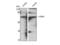 mRNA-decapping enzyme 1A antibody, STJ95708, St John