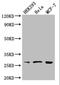 Nudix Hydrolase 21 antibody, A63058-100, Epigentek, Western Blot image 