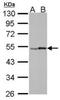 Retinoic Acid Receptor Gamma antibody, orb181656, Biorbyt, Western Blot image 
