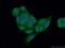 X-Linked Inhibitor Of Apoptosis antibody, 23453-1-AP, Proteintech Group, Immunofluorescence image 