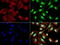 DNA excision repair protein ERCC-1 antibody, LS-C799201, Lifespan Biosciences, Immunofluorescence image 