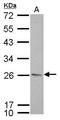 p33 antibody, TA308865, Origene, Western Blot image 