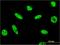 Proline/serine-rich coiled-coil protein 2 antibody, H00196441-M07, Novus Biologicals, Immunofluorescence image 