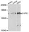 Centrosome and spindle pole-associated protein 1 antibody, A9983, ABclonal Technology, Western Blot image 