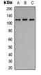 Lysosomal Associated Membrane Protein 1 antibody, abx121563, Abbexa, Western Blot image 