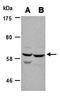 SRC Proto-Oncogene, Non-Receptor Tyrosine Kinase antibody, orb66978, Biorbyt, Western Blot image 