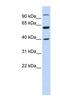 Leucine Zipper And EF-Hand Containing Transmembrane Protein 2 antibody, NBP1-56618, Novus Biologicals, Western Blot image 