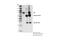Bruton Tyrosine Kinase antibody, 56044S, Cell Signaling Technology, Immunoprecipitation image 