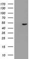 Epoxide Hydrolase 1 antibody, TA800409, Origene, Western Blot image 