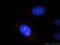 Nucleolar Protein 8 antibody, 12043-1-AP, Proteintech Group, Immunofluorescence image 