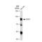 Signal Transducer And Activator Of Transcription 1 antibody, GTX01292, GeneTex, Western Blot image 