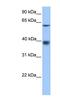 Major Facilitator Superfamily Domain Containing 4A antibody, NBP1-91445, Novus Biologicals, Western Blot image 
