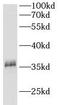 Carbonic Anhydrase 11 antibody, FNab01157, FineTest, Western Blot image 