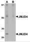 Jumonji Domain Containing 4 antibody, NBP2-82098, Novus Biologicals, Western Blot image 