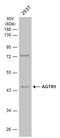 Angiotensin II type-1 receptor antibody, GTX132965, GeneTex, Western Blot image 