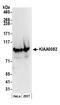 Cap Methyltransferase 1 antibody, NB100-79786, Novus Biologicals, Western Blot image 