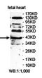 Lectin, Mannose Binding 2 Like antibody, orb78419, Biorbyt, Western Blot image 