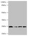 Glutathione S-transferase kappa 1 antibody, A57249-100, Epigentek, Western Blot image 