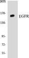 EGFR antibody, EKC1185, Boster Biological Technology, Western Blot image 