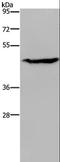 Acid Phosphatase 6, Lysophosphatidic antibody, LS-C405123, Lifespan Biosciences, Western Blot image 