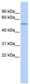Peroxisome Proliferator Activated Receptor Delta antibody, TA343593, Origene, Western Blot image 