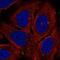 Adenylate Cyclase 7 antibody, NBP2-58945, Novus Biologicals, Immunocytochemistry image 