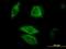 Dual Specificity Phosphatase 6 antibody, ab54940, Abcam, Immunofluorescence image 