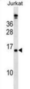 Placenta-specific protein 4 antibody, abx028782, Abbexa, Western Blot image 
