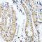Collagen alpha-1(IX) chain antibody, abx006360, Abbexa, Western Blot image 