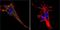 Potassium voltage-gated channel subfamily KQT member 2 antibody, GTX82891, GeneTex, Immunofluorescence image 