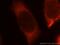 Abhydrolase Domain Containing 5 antibody, 12201-1-AP, Proteintech Group, Immunofluorescence image 
