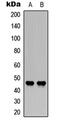 Coagulation Factor III, Tissue Factor antibody, abx121567, Abbexa, Western Blot image 