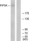 1-phosphatidylinositol-3-phosphate 5-kinase antibody, TA316220, Origene, Western Blot image 