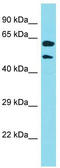 Keratin 39 antibody, TA337399, Origene, Western Blot image 