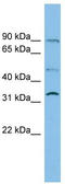 Solute Carrier Family 27 Member 3 antibody, TA333683, Origene, Western Blot image 
