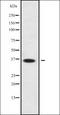 Major urinary protein 20 antibody, orb334972, Biorbyt, Western Blot image 