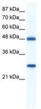 DExD-Box Helicase 39B antibody, TA341568, Origene, Western Blot image 