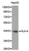 DnaJ Heat Shock Protein Family (Hsp40) Member B6 antibody, orb378036, Biorbyt, Western Blot image 