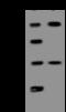 BCL9 Transcription Coactivator antibody, 206684-T32, Sino Biological, Western Blot image 