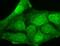 Potassium Calcium-Activated Channel Subfamily M Regulatory Beta Subunit 3 antibody, NBP2-12916, Novus Biologicals, Immunocytochemistry image 