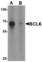 BCL6 Transcription Repressor antibody, LS-B8852, Lifespan Biosciences, Western Blot image 