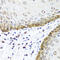 Bone Morphogenetic Protein 5 antibody, 23-558, ProSci, Immunohistochemistry paraffin image 