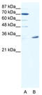 Melanoma-associated antigen 9 antibody, TA343533, Origene, Western Blot image 