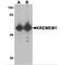 Kringle Containing Transmembrane Protein 1 antibody, MBS153356, MyBioSource, Western Blot image 