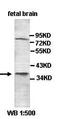 Notch Receptor 4 antibody, orb77434, Biorbyt, Western Blot image 
