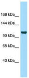 Inter-alpha-trypsin inhibitor heavy chain H5 antibody, TA331263, Origene, Western Blot image 