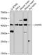 Ciliary neurotrophic factor receptor subunit alpha antibody, 18-773, ProSci, Western Blot image 